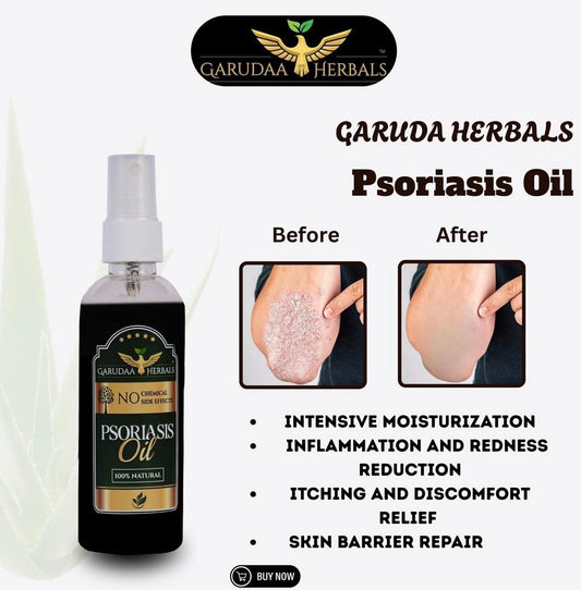 Garuda Herbal Psoriasis Oil-Advanced Psoriasis Clearing Oil